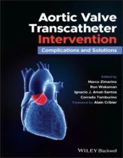 Aortic Valve Transcatheter Intervention: Complications And Solutions,2021 EPUB