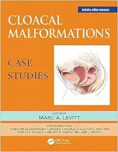 Cloacal Malformations: Case Studies (Pediatric Colorectal Surgery) (Original PDF