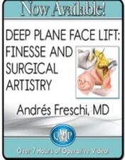 Deep Plane Face Lift: Finesse And Surgical Artistry 2023 (Videos)