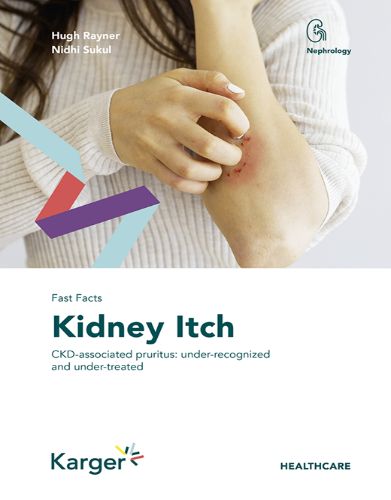 Fast Facts: Kidney Itch (Original PDF