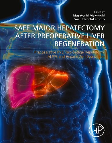 Safe Major Hepatectomy After Preoperative Liver Regeneration: Preopearative PVE, Two-Satage Hepatetomy, ALPPS And Hepatic Vein Deprivation (Original PDF From Publisher)