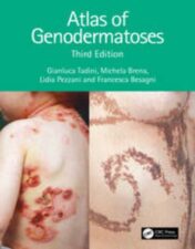 Atlas Of Genodermatoses 3e (Original PDF