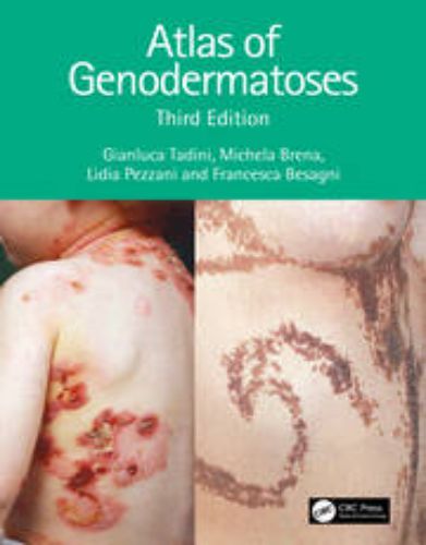 Atlas Of Genodermatoses 3e (Original PDF