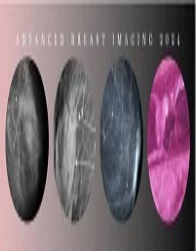 Advanced Breast Imaging 2024 – CMEScience (Videos)