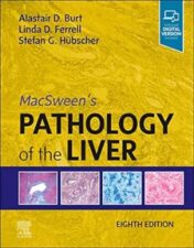 MacSween’s Pathology Of The Liver, 8th Edition ,2022 True PDF