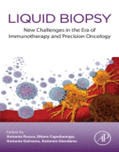 Liquid Biopsy New Challenges in the Era of Immunotherapy and Precision Oncology