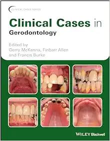 Clinical Cases In Gerodontology (Clinical Cases (Dentistry)) (Original PDF