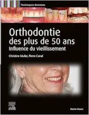 Orthodontie Des Plus De 50 Ans: Influence Du Vieillissement (True PDF