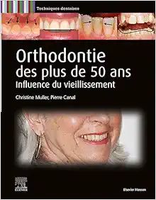 Orthodontie Des Plus De 50 Ans: Influence Du Vieillissement (True PDF