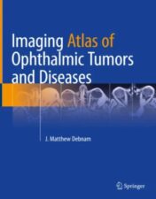 Imaging Atlas of Ophthalmic Tumors and Diseases , 2023 Original PDF