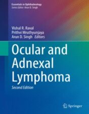 Ocular and Adnexal Lymphoma