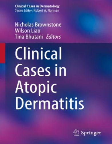 Clinical Cases in Atopic Dermatitis, 2024 Original PDF