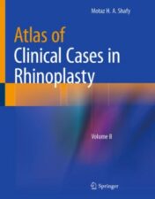 Atlas of Clinical Cases in Rhinoplasty Volume II