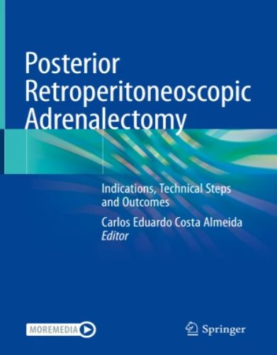 Posterior Retroperitoneoscopic Adrenalectomy 2023 Original PDF