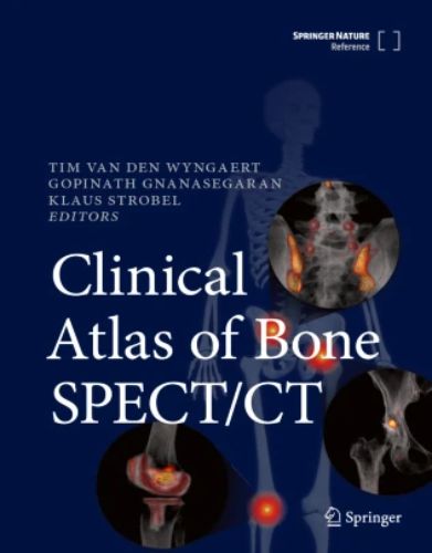 Clinical Atlas of Bone SPECT/CT, 2023 original pdf