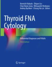 Thyroid FNA Cytology Differential Diagnoses and Pitfalls