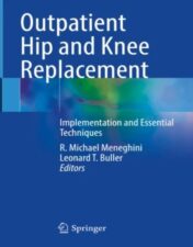 Outpatient Hip and Knee Replacement, 2023 original pdf