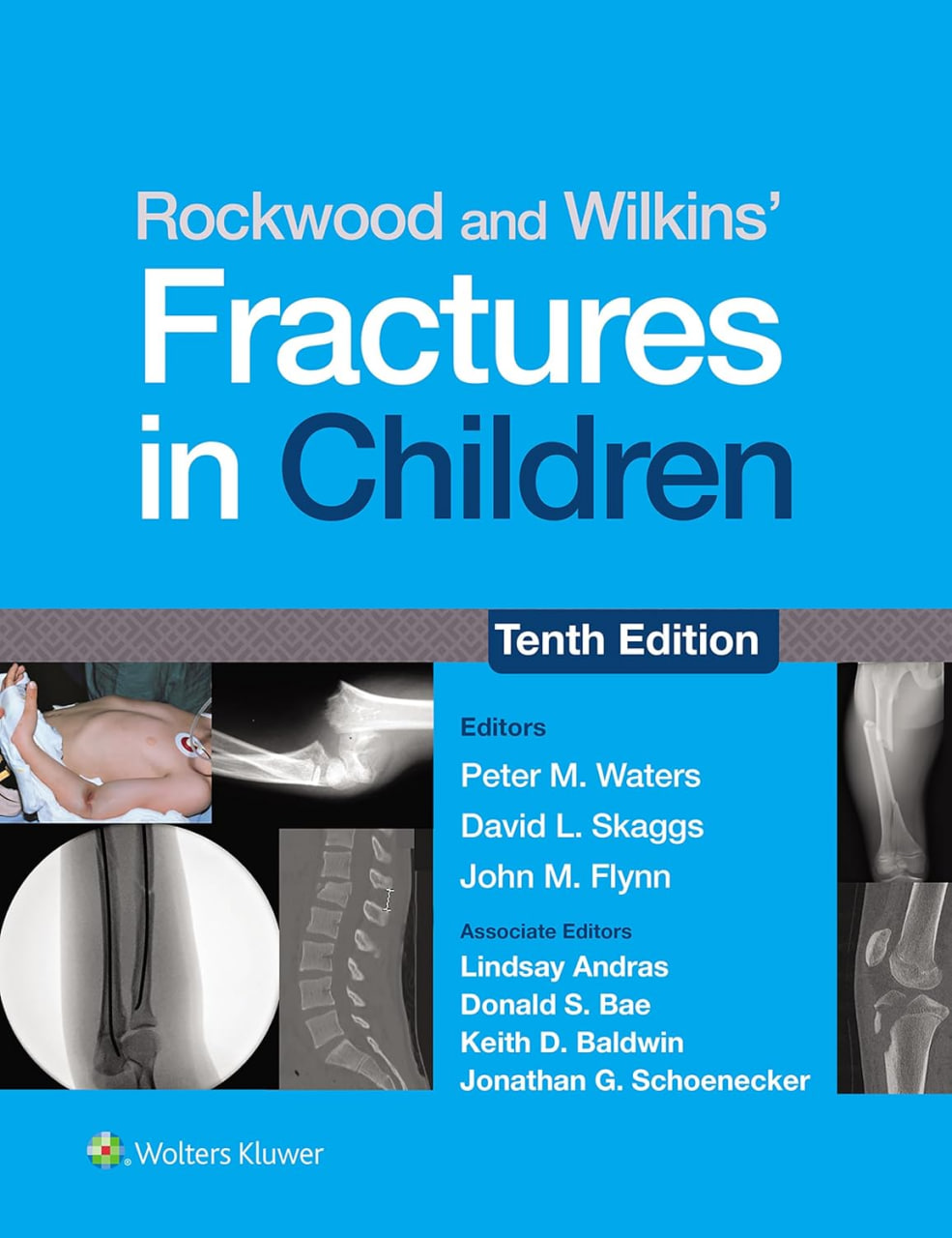 Rockwood and Wilkins' Fractures in Children: eBook without Multimedia 10th