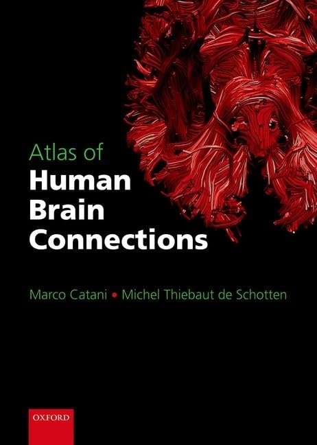 Atlas of Human Brain Connections