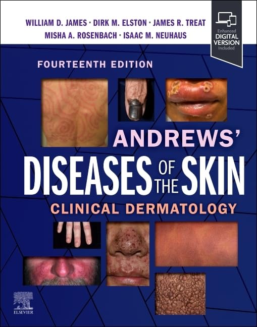 Andrews' Diseases of the Skin: Clinical Dermatology 14th