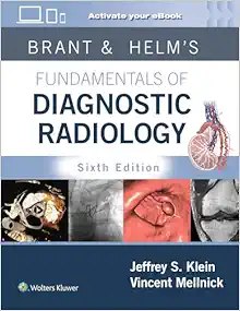 Brant & Helms' Fundamentals of Diagnostic Radiology: Print + eBook with Multimedia Sixth Edition