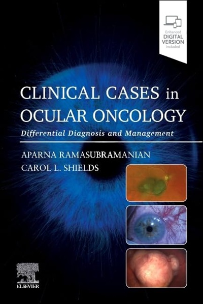 Clinical Cases in Ocular Oncology: Differential Diagnosis and Management 1st Edition