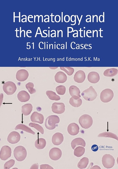 Haematology and the Asian Patient: 51 Clinical Cases 1st Edition