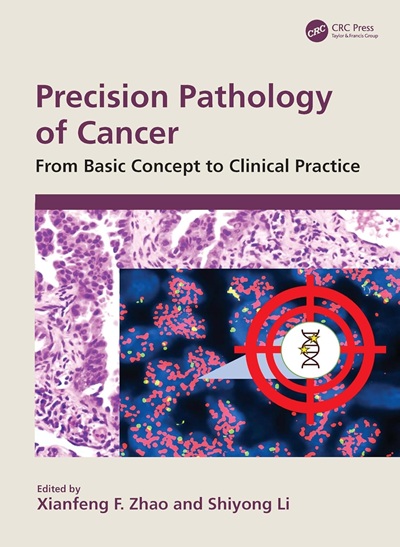 Precision Pathology of Cancer: From Basic Concept to Clinical Practice 1st Edition