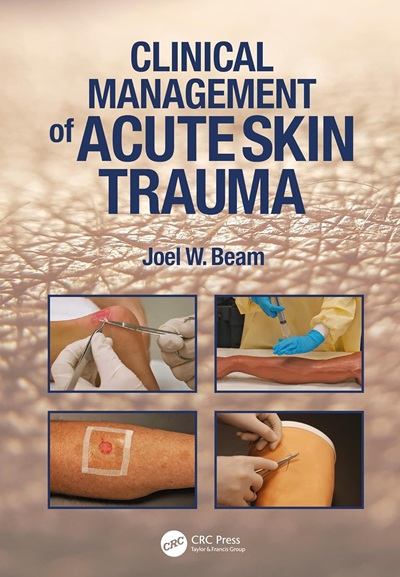 Clinical Management of Acute Skin Trauma 1st Edition