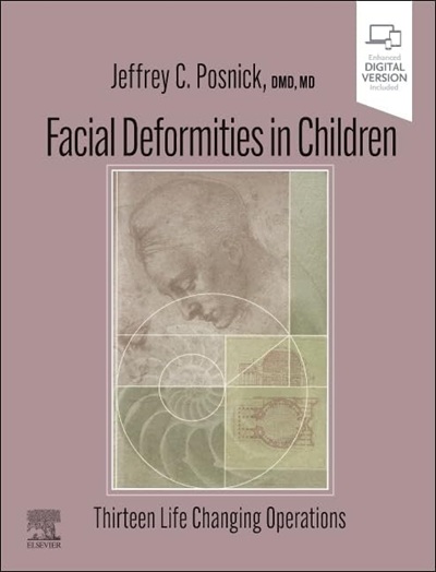 Facial Deformities in Children: Thirteen Life Changing Operations 1st Edition