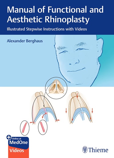 Manual of Functional and Aesthetic Rhinoplasty