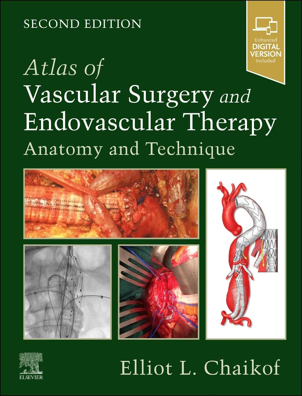 Atlas of Vascular Surgery and Endovascular Therapy: Anatomy and Technique 2nd Edition Original PDF+Video's 2025