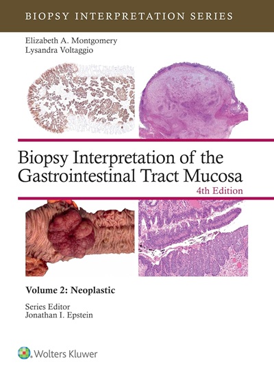 Biopsy Interpretation of the Gastrointestinal Tract Mucosa Volume 2: Neoplastic: eBook without Multimedia (Biopsy Interpretation Series) 4th Edition, Kindle Edition