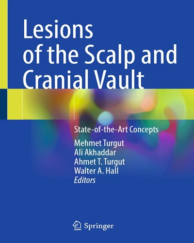 Lesions of the Scalp and Cranial Vault

State-of-the-Art Concepts Original PDF 2025