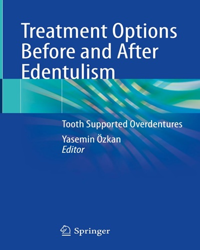 Treatment Options Before and After Edentulism  Tooth Supported Overdentures