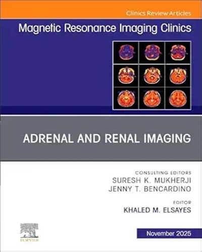 Adrenal and Renal Imaging, An Issue of Magnetic Resonance Imaging Clinics of North America (Volume 33-4) (The Clinics: Radiology, Volume 33-4) Original PDF 2025