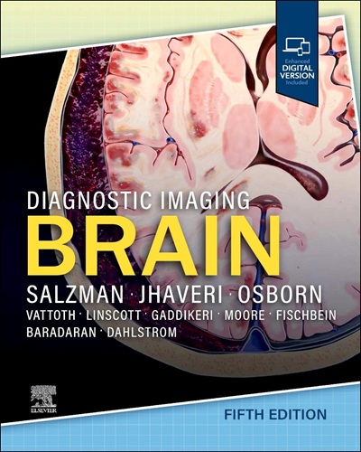 Diagnostic Imaging: Brain 5th Edition